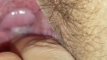 Brunette Cervix Porn Pics